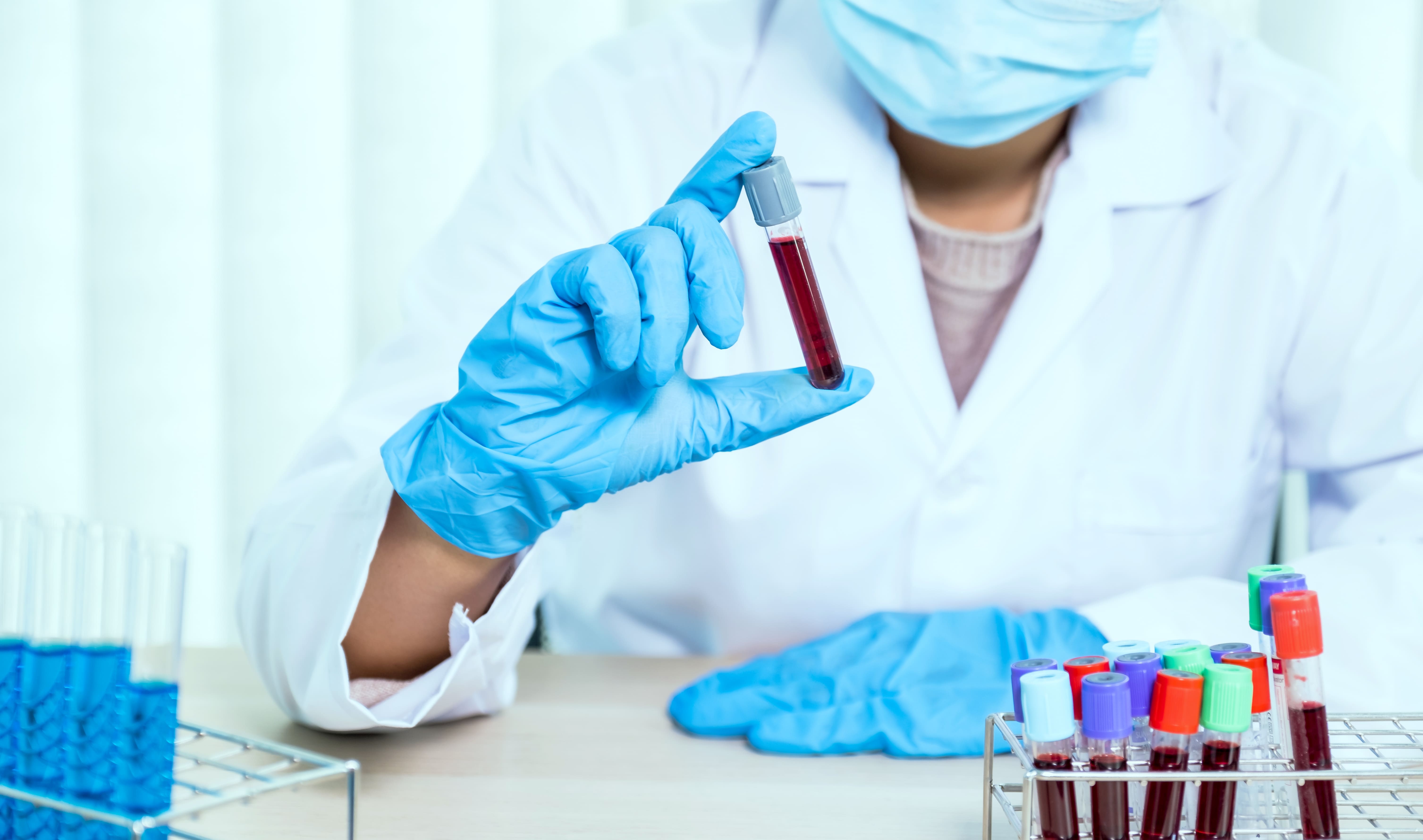 Анализы на рак кишечника